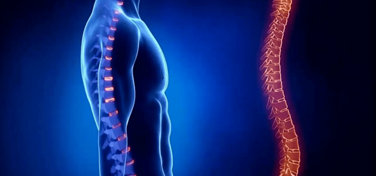 Lésions de la colonne vertébrale dues à l'ostéochondrose